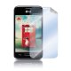 Celly SBF396 protezione per lo schermo e il retro dei telefoni cellulari LG 2 pz 2
