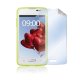 Celly SBF432 protezione per lo schermo e il retro dei telefoni cellulari LG 2 pz 2